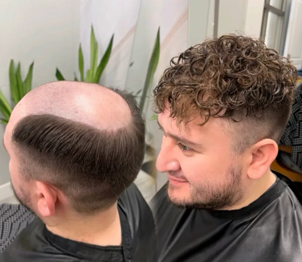 Men's hair replacement procedure luling