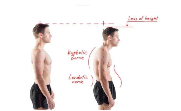 The 7 Warning Signs You Need Professional Posture Correction