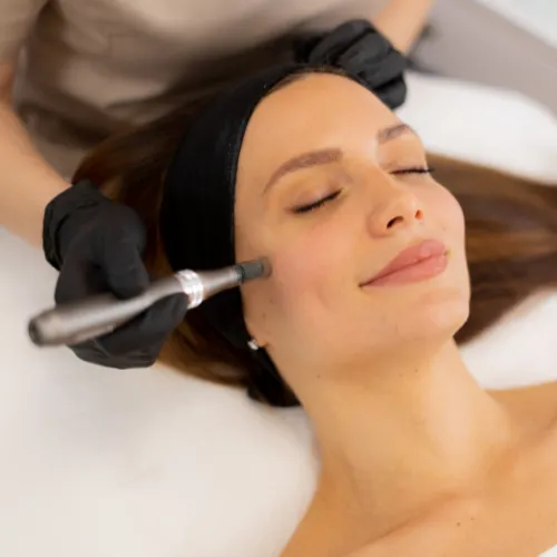 Soin de la peau mrironeedling Mons, soin peau neuve Naturellement belle