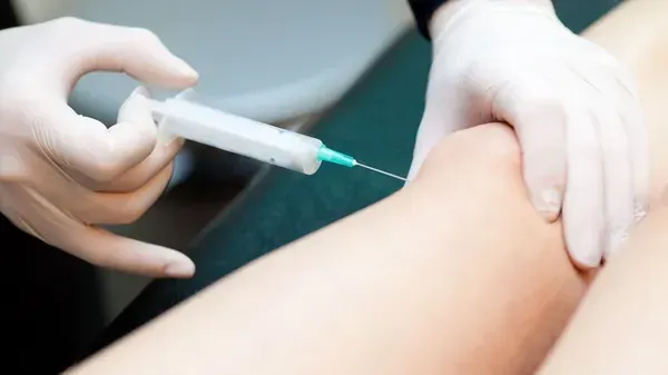 Rejuvenecimiento facial con PRP en Amado Clinic
