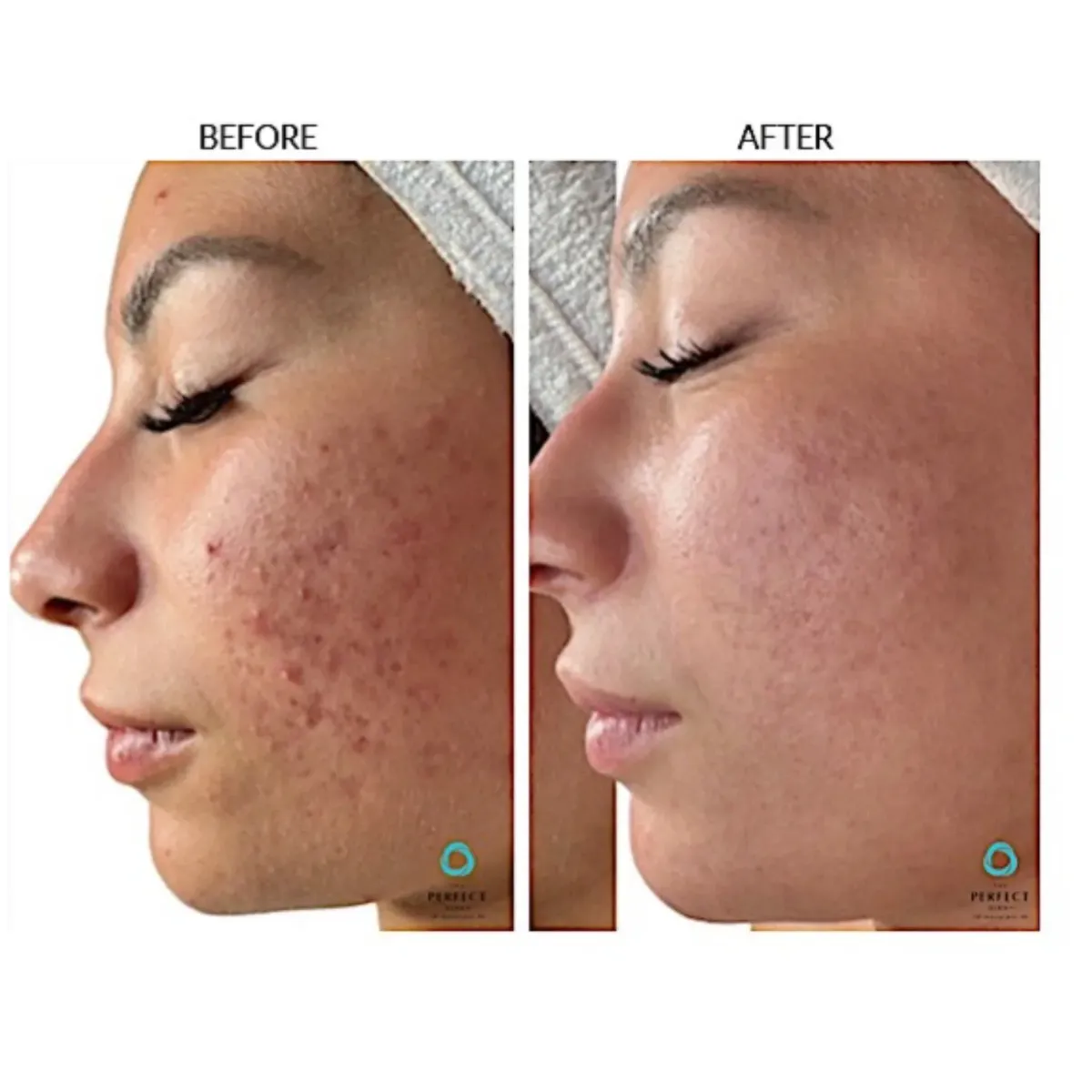 Consulta facial personalizada en Miami, Florida