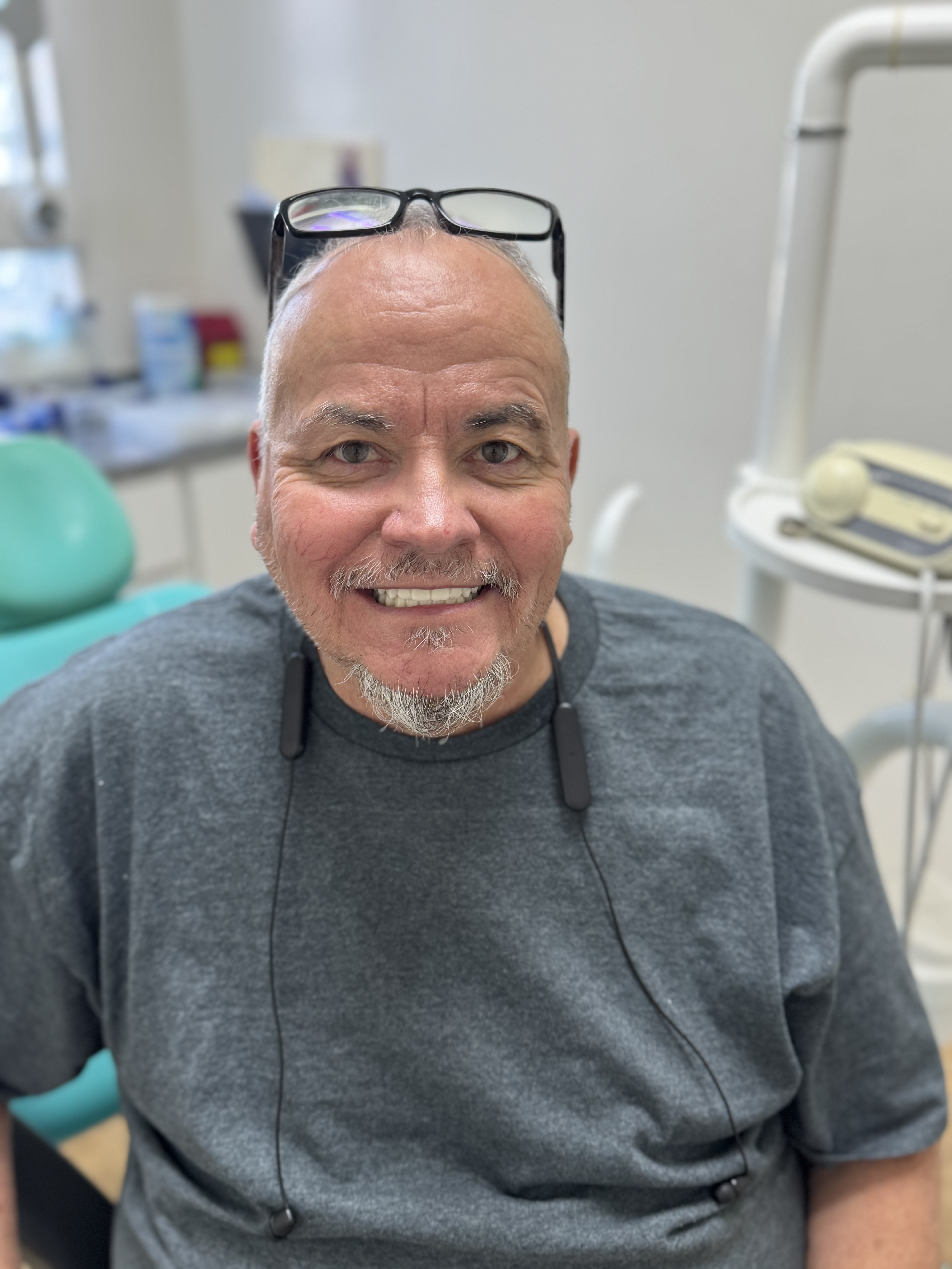 Before and after dental implant restoration split view for patient David K