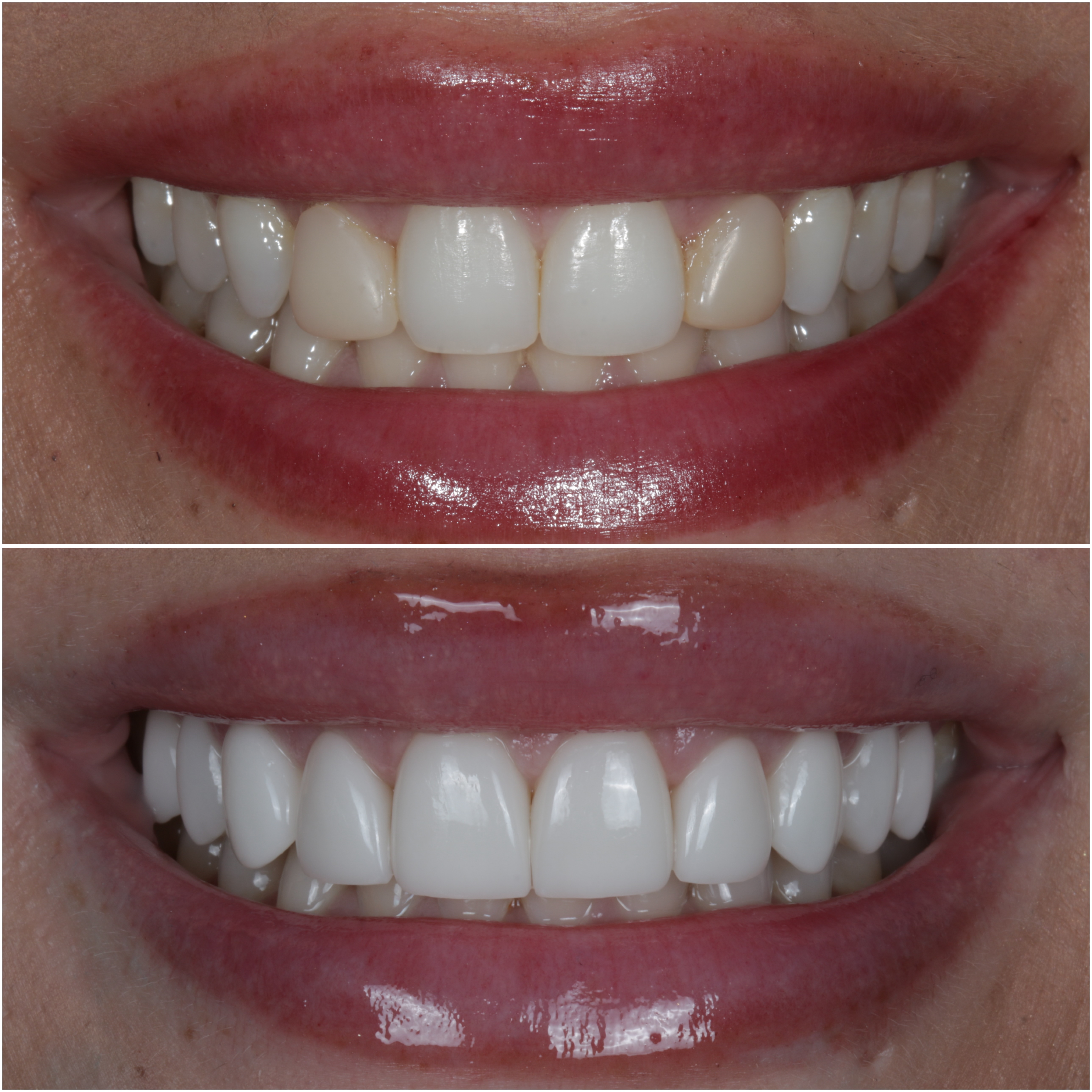 BloomShield glass jar on a wooden retail shelf with natural greenery and soft morning light.