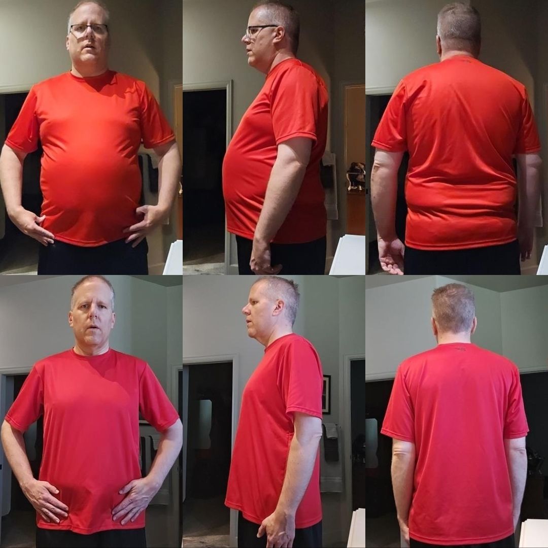 Client transformation before and after progress photo