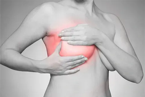 Breast Engorgement & Mastitis