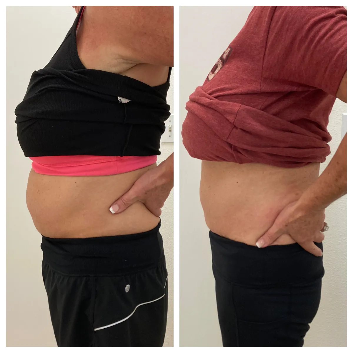 Satisfied medical spa client portrait showing natural results
