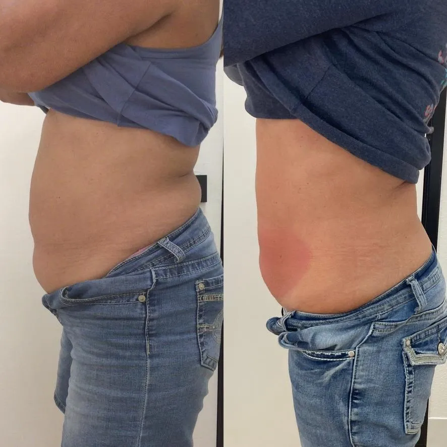 Satisfied medical spa client portrait showing natural results