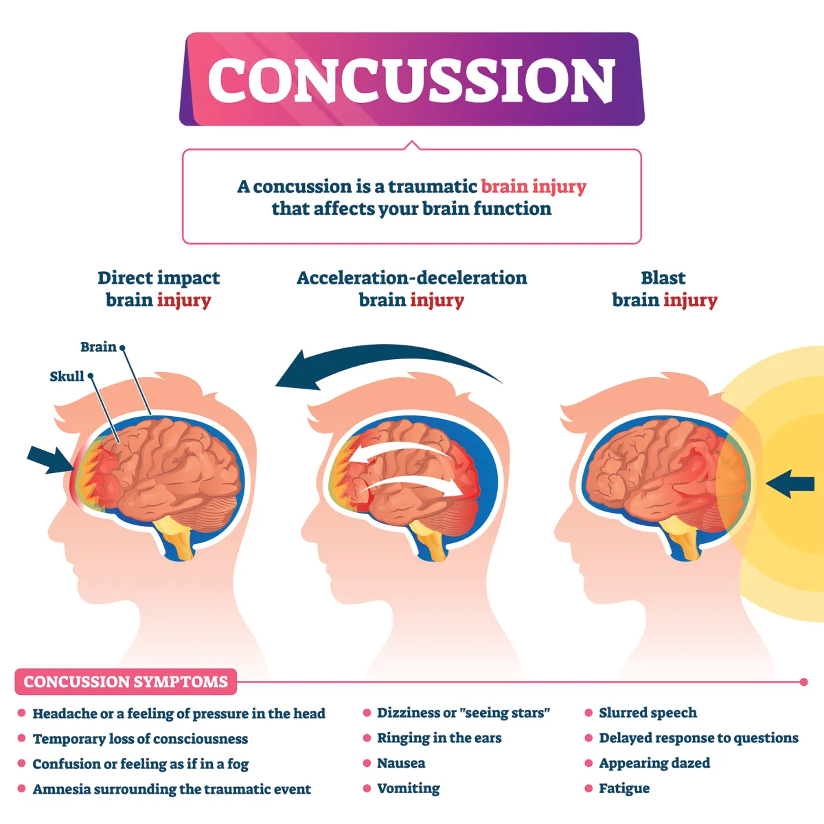 concussion injuries