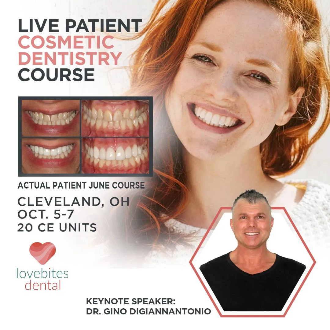 Live Aesthetic Dental Smile Make-Over Course