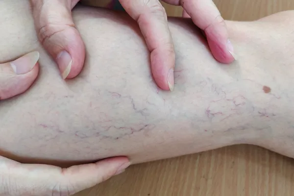 The Power of Ablation