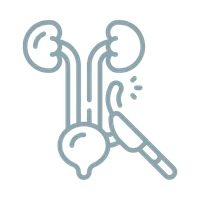 O que é Duplicidade Ureteral