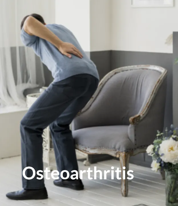 Osteoarthritis