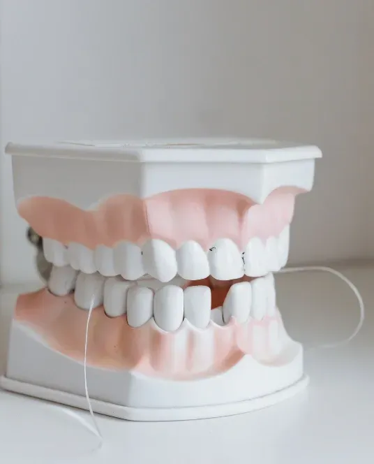Detailed dental model showing the teeth and gums for treatment planning and patient education.