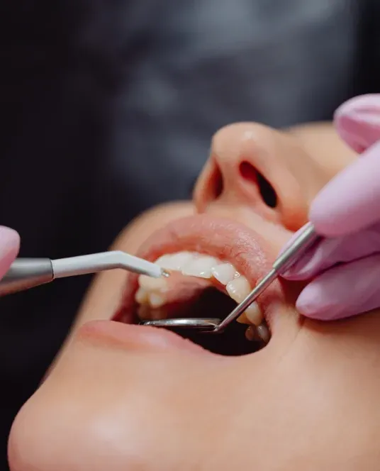 Close-up of a patient receiving a professional dental examination using dental instruments.