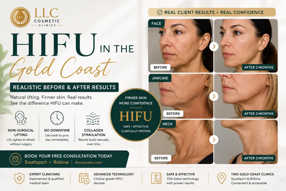 HIFU before and after results guide for skin tightening on the Gold Coast
