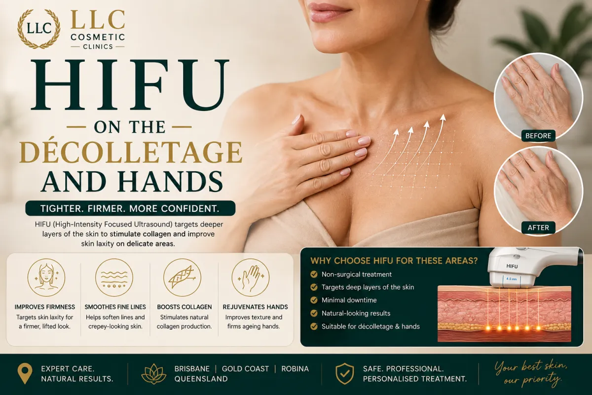 HIFU treatment for the décolletage and hands for skin tightening 