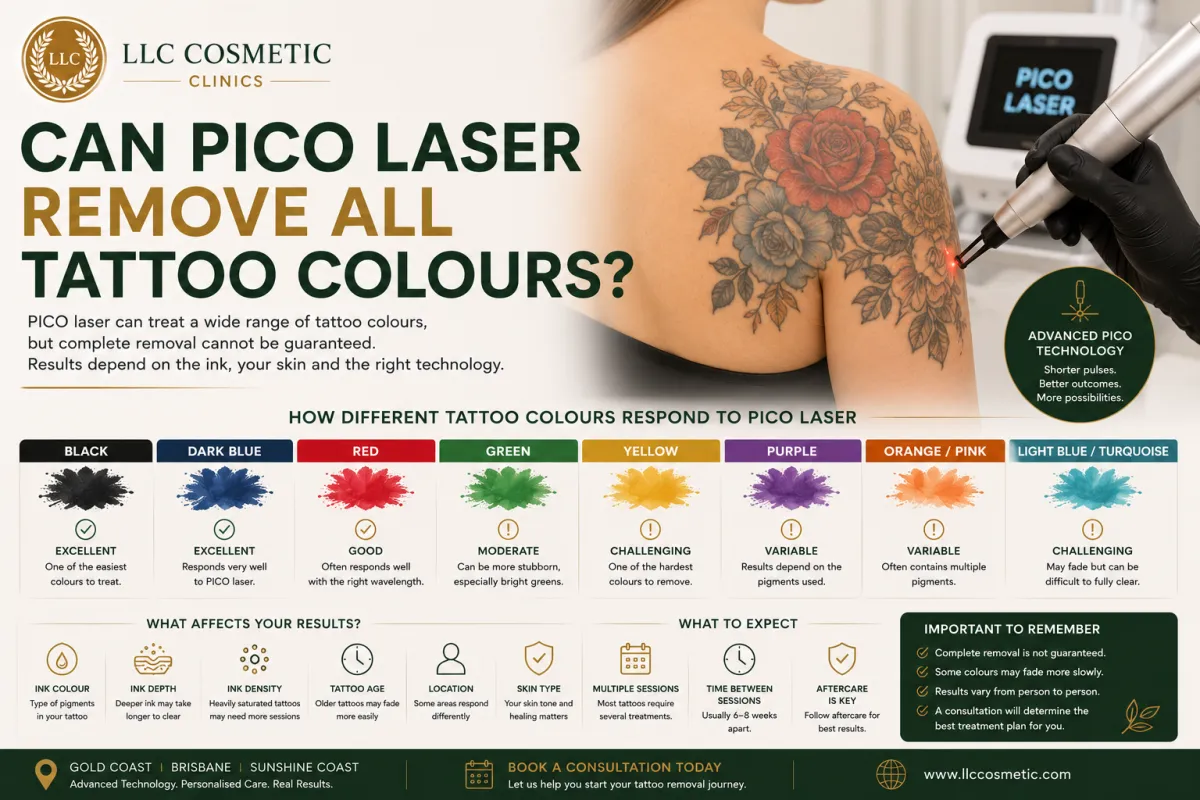 PICO laser tattoo removal for different tattoo colours