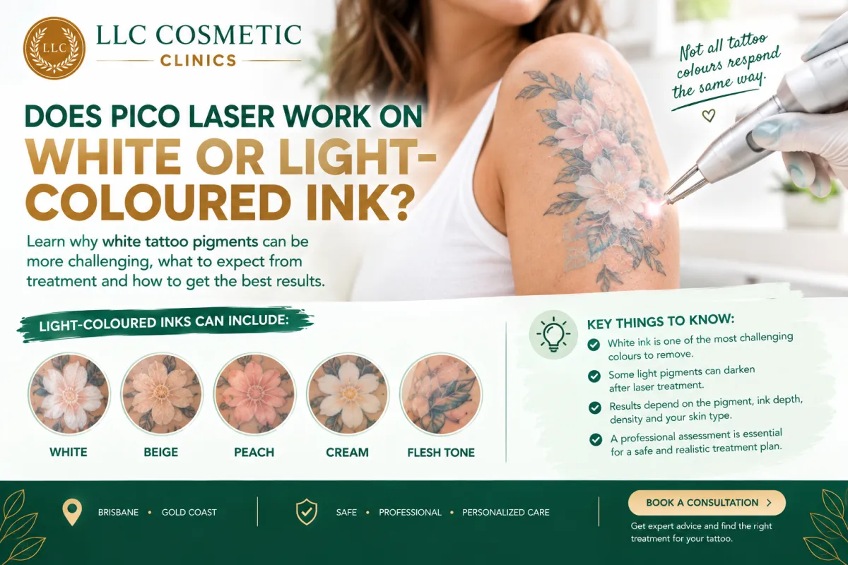 Does PICO Laser Work on White or Light-Coloured Ink?