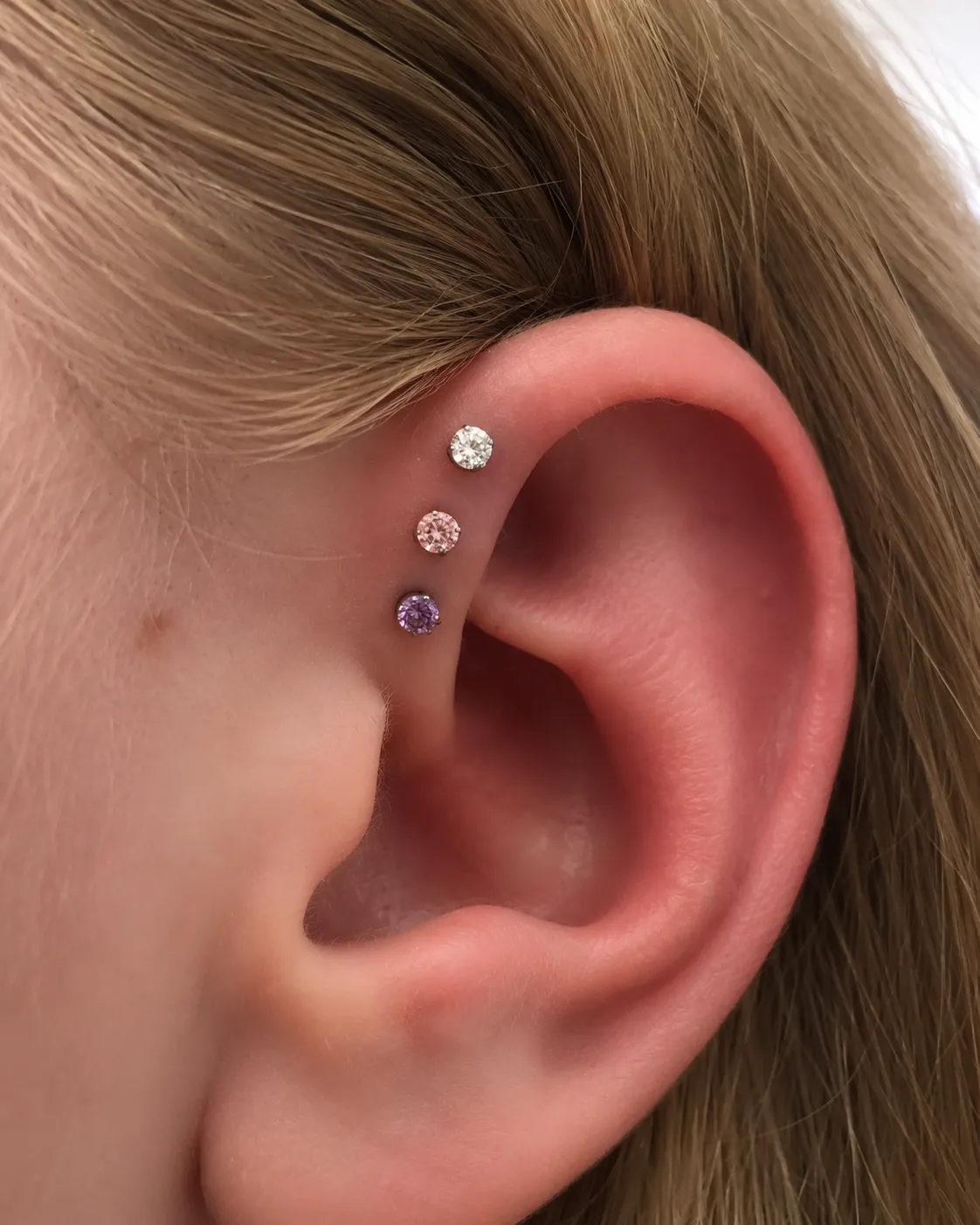 forward helix homer glen il