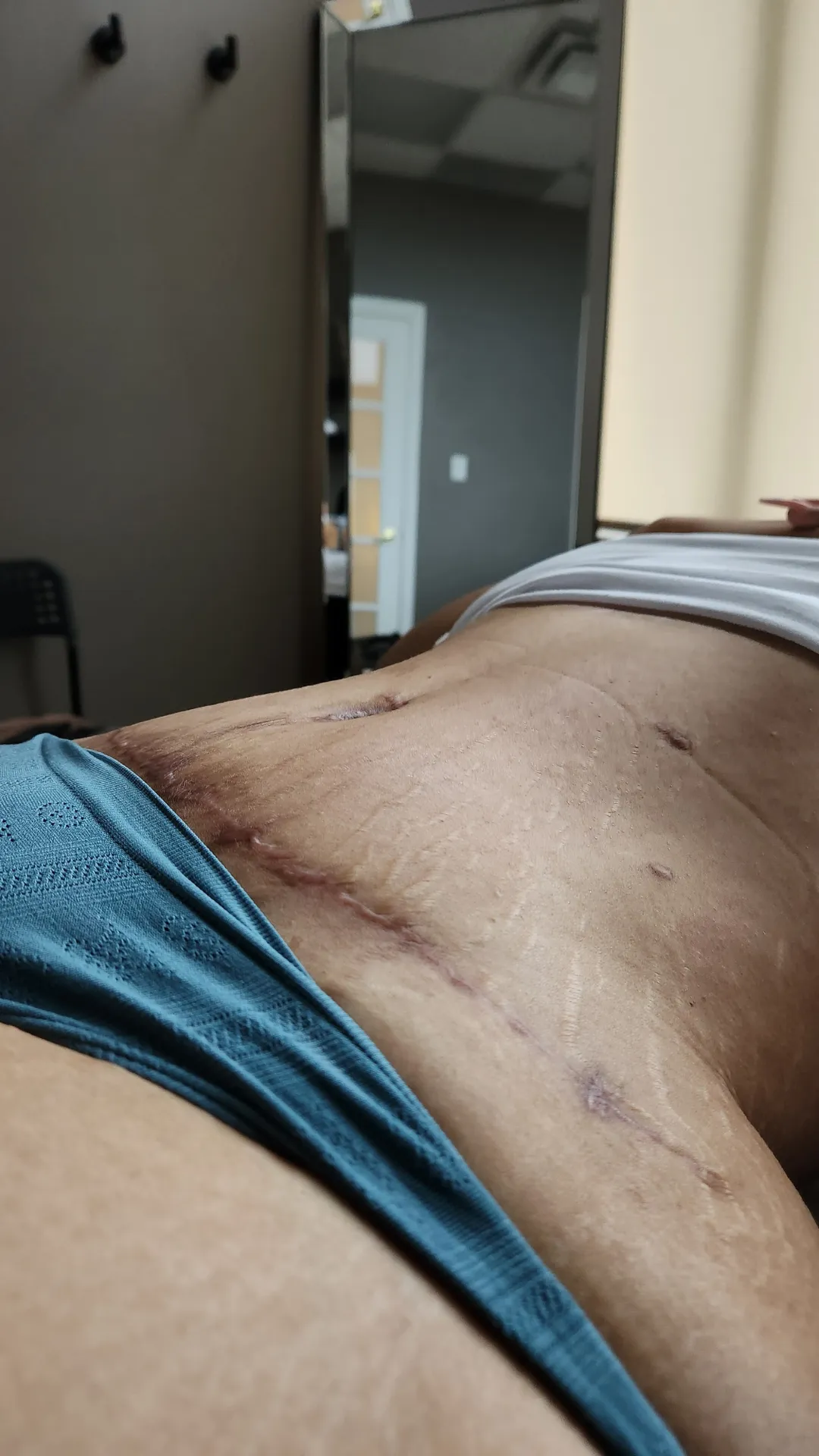 massage therapy toronto post op brazilian lymphatic drainage massage after lipo 