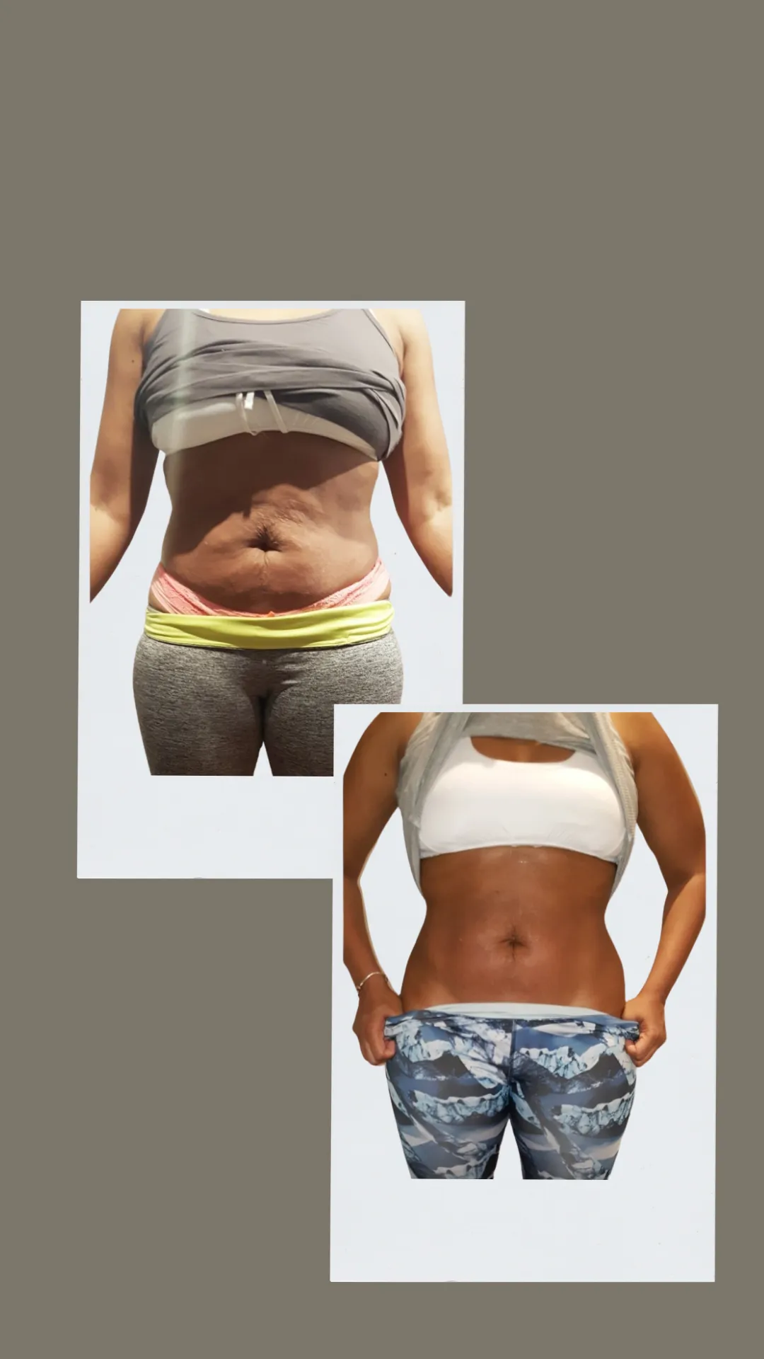 body contouring and post op lymphatic drainage massage therapy non invasive body sculpting fat loss