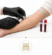 ZIE Infusion services - lab draws