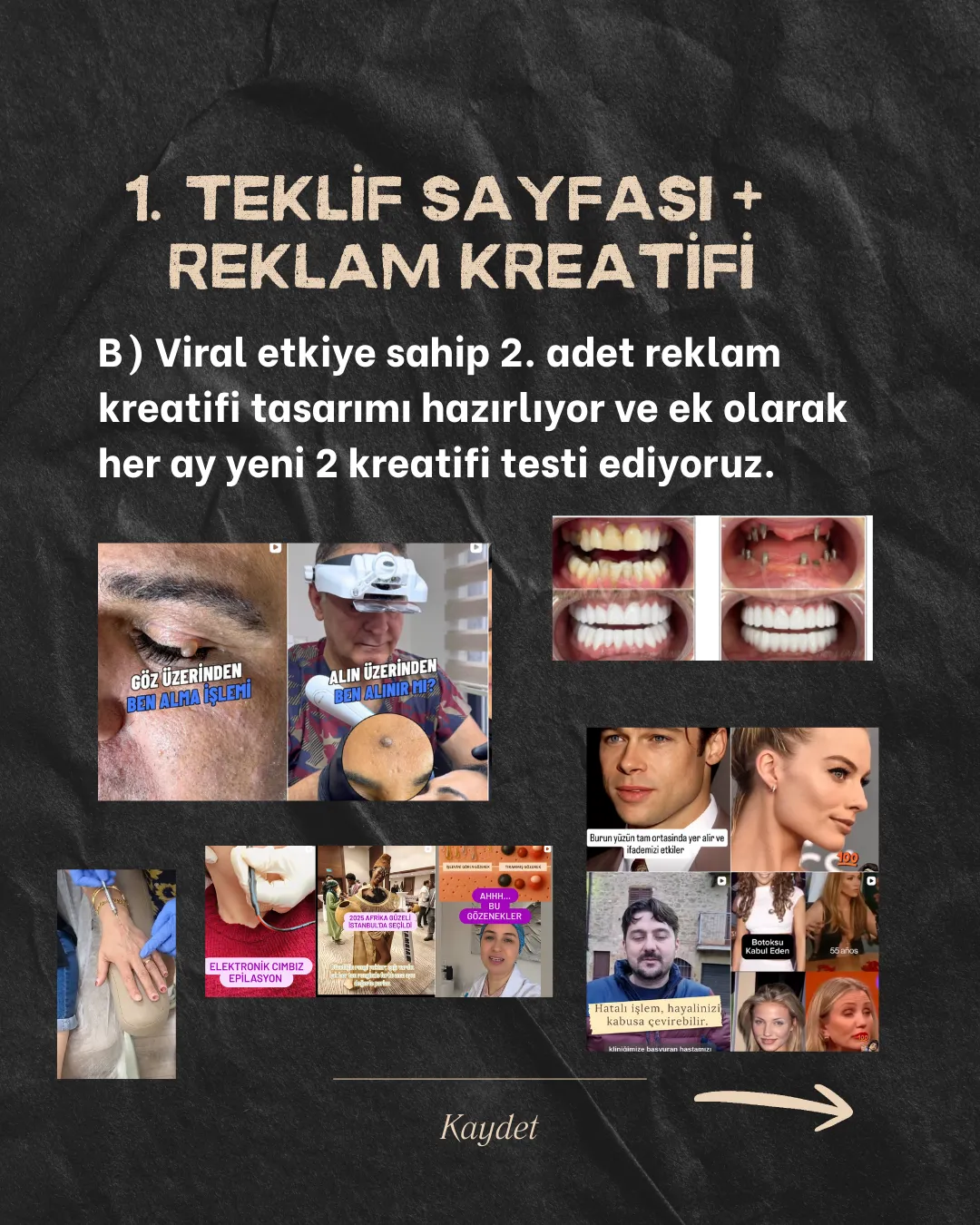 time lapse car running on road