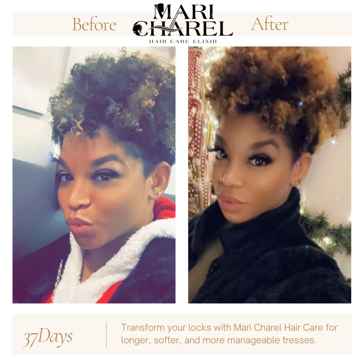 Hair Growth At its best