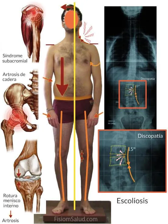 fisioterapia