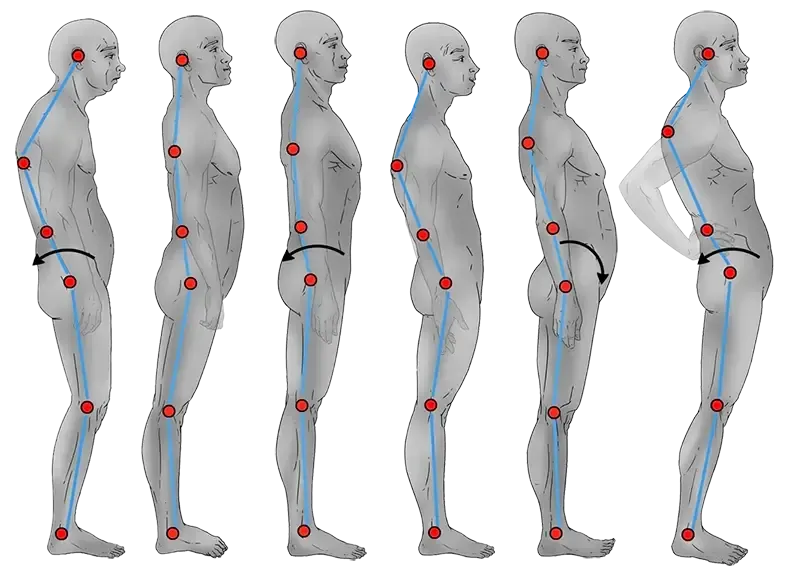 analisis postural