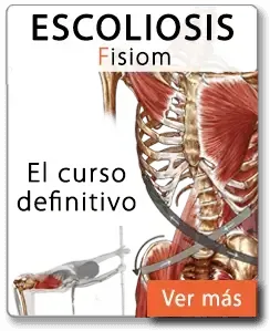 ejercicios escoliosis