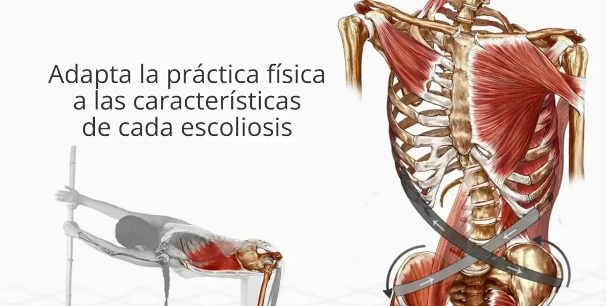 Escoliosis ejercicios