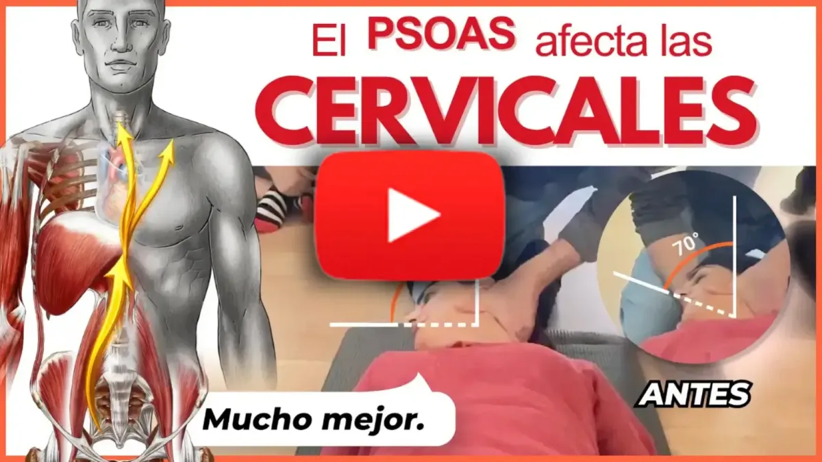 dolor por ernia discal