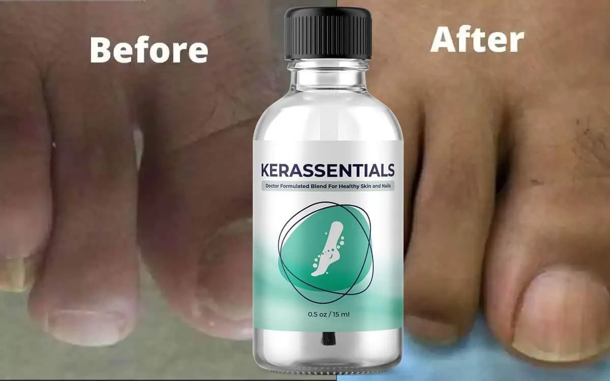 kerassentials review