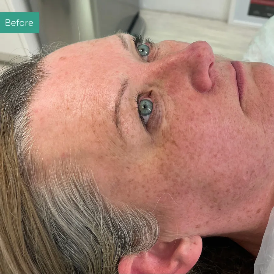 Before Image of Client from PMU Dorset