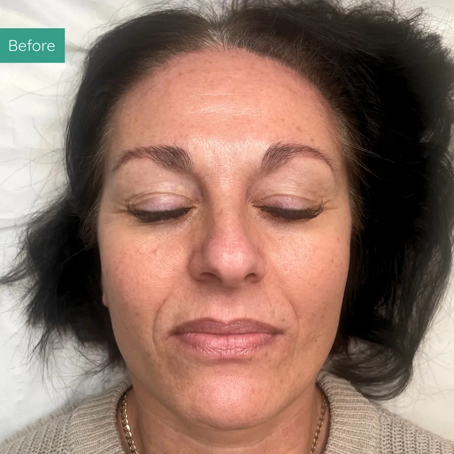 Before image of client from PMU Dorset