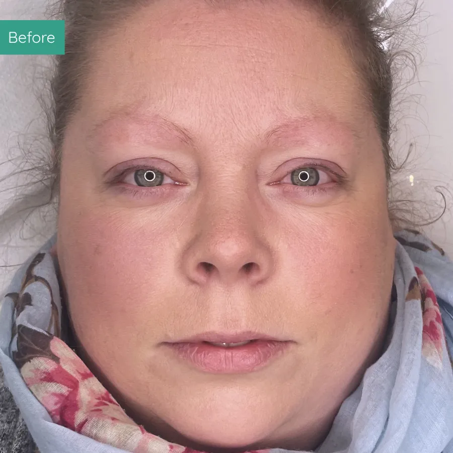 Before image of client from PMU Dorset