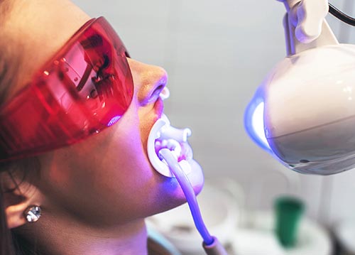 Tandblekning in Uppsala