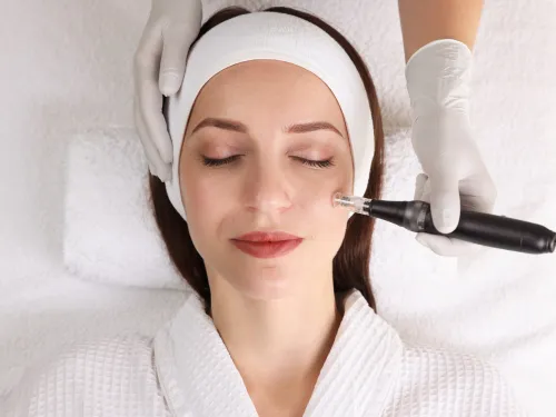 Hollywoodpeeling in Uppsala