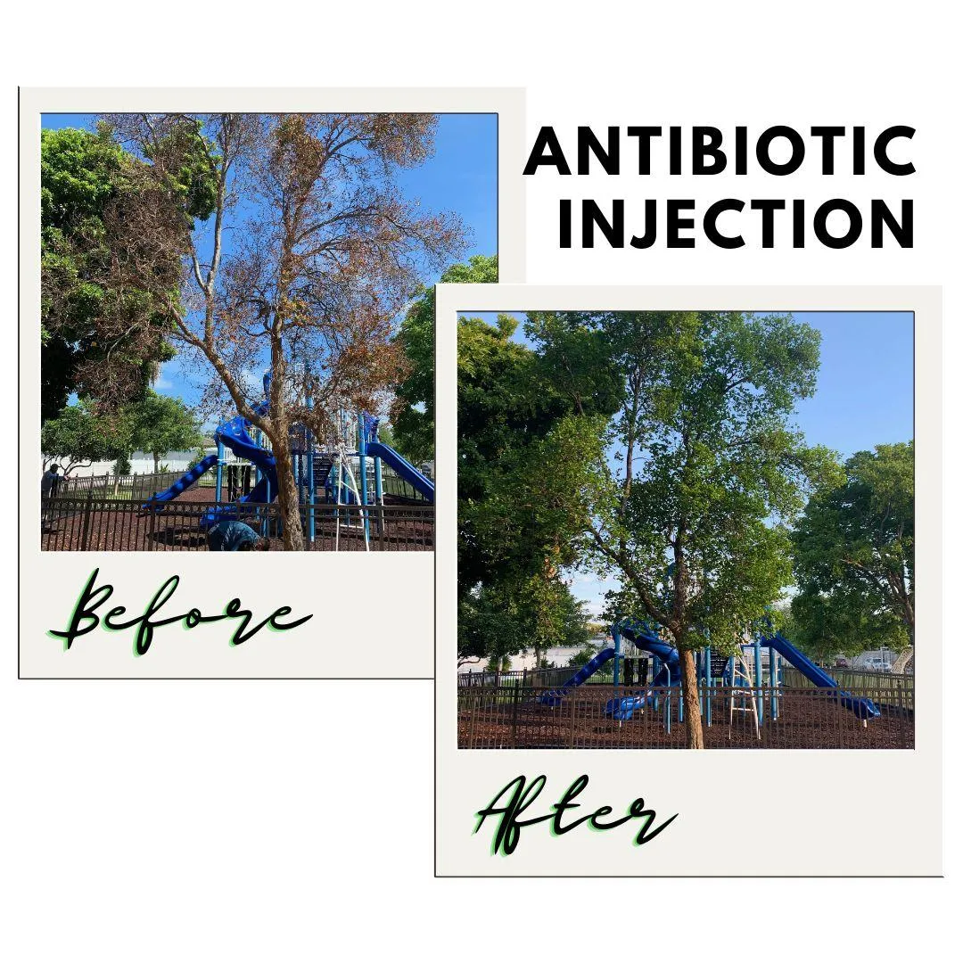 Antibiotic Injection