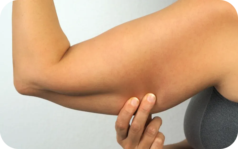 criolipolisi braccia