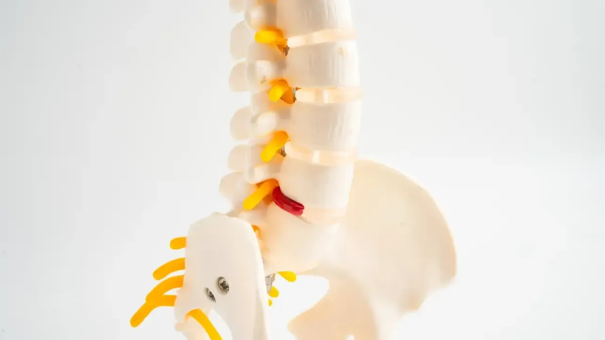 Sciatica Treatment Lawrenceville, GA