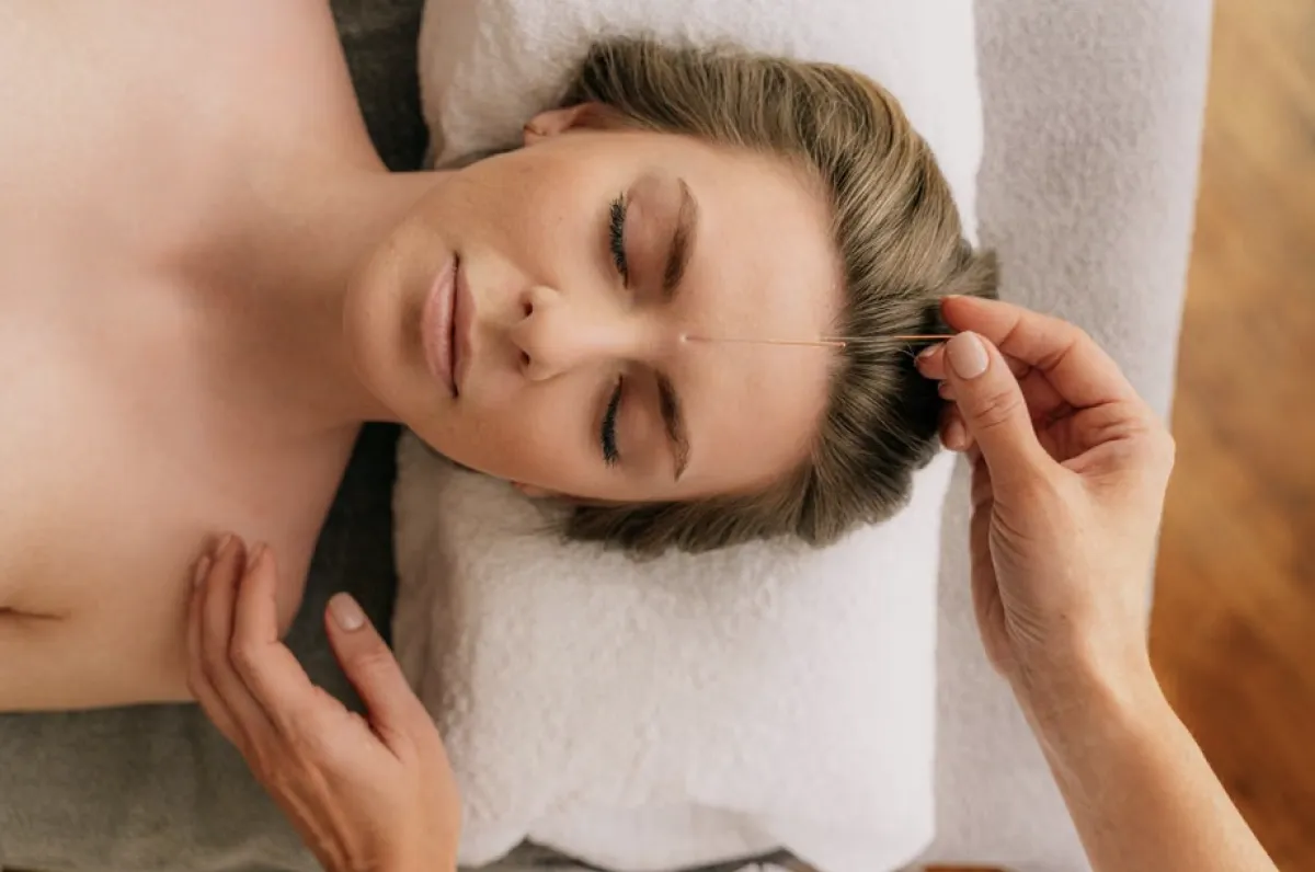 acupuncture for eye bags