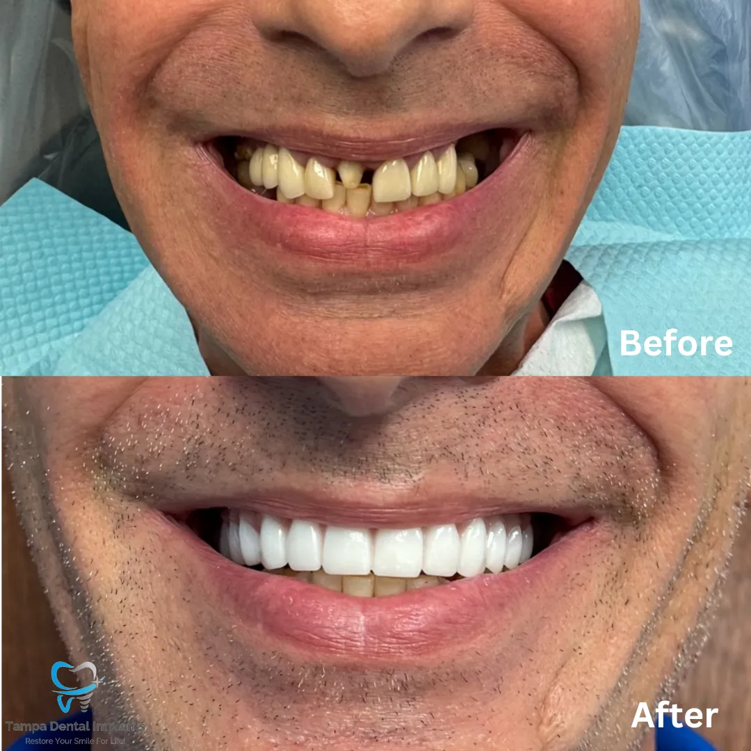 Smile Makeovers