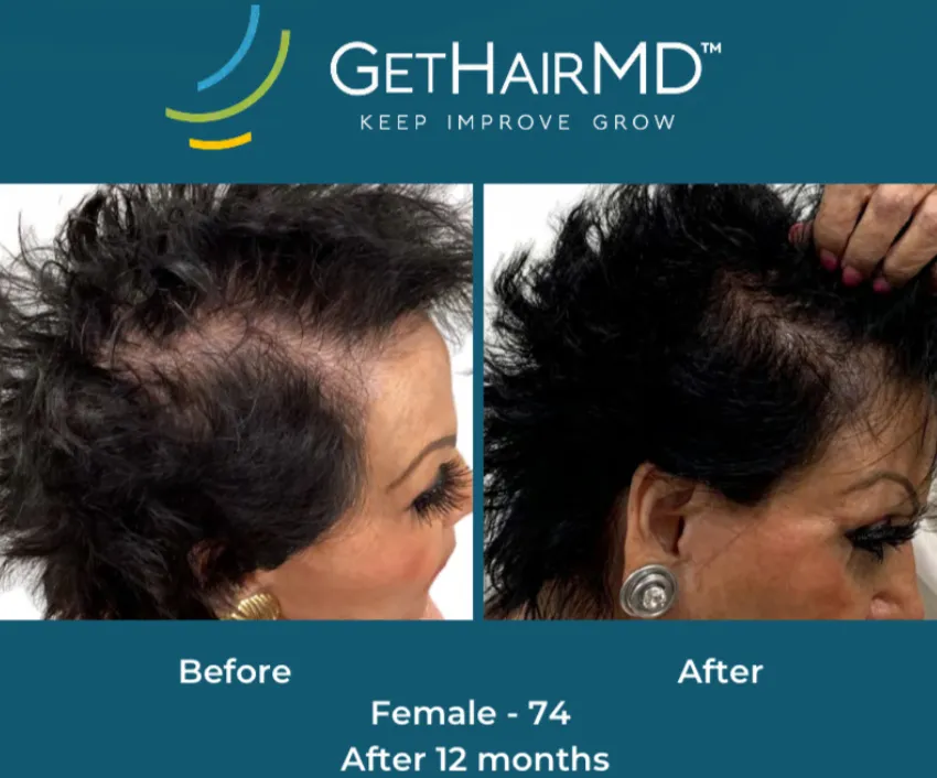 Client result 2