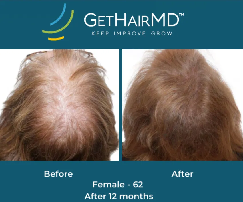 Client result 3