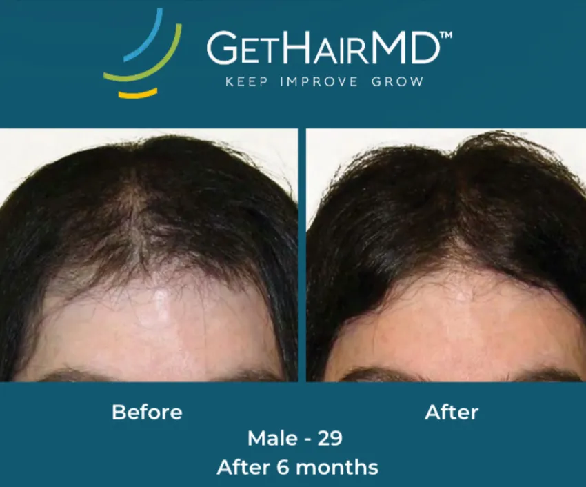 Client result 1