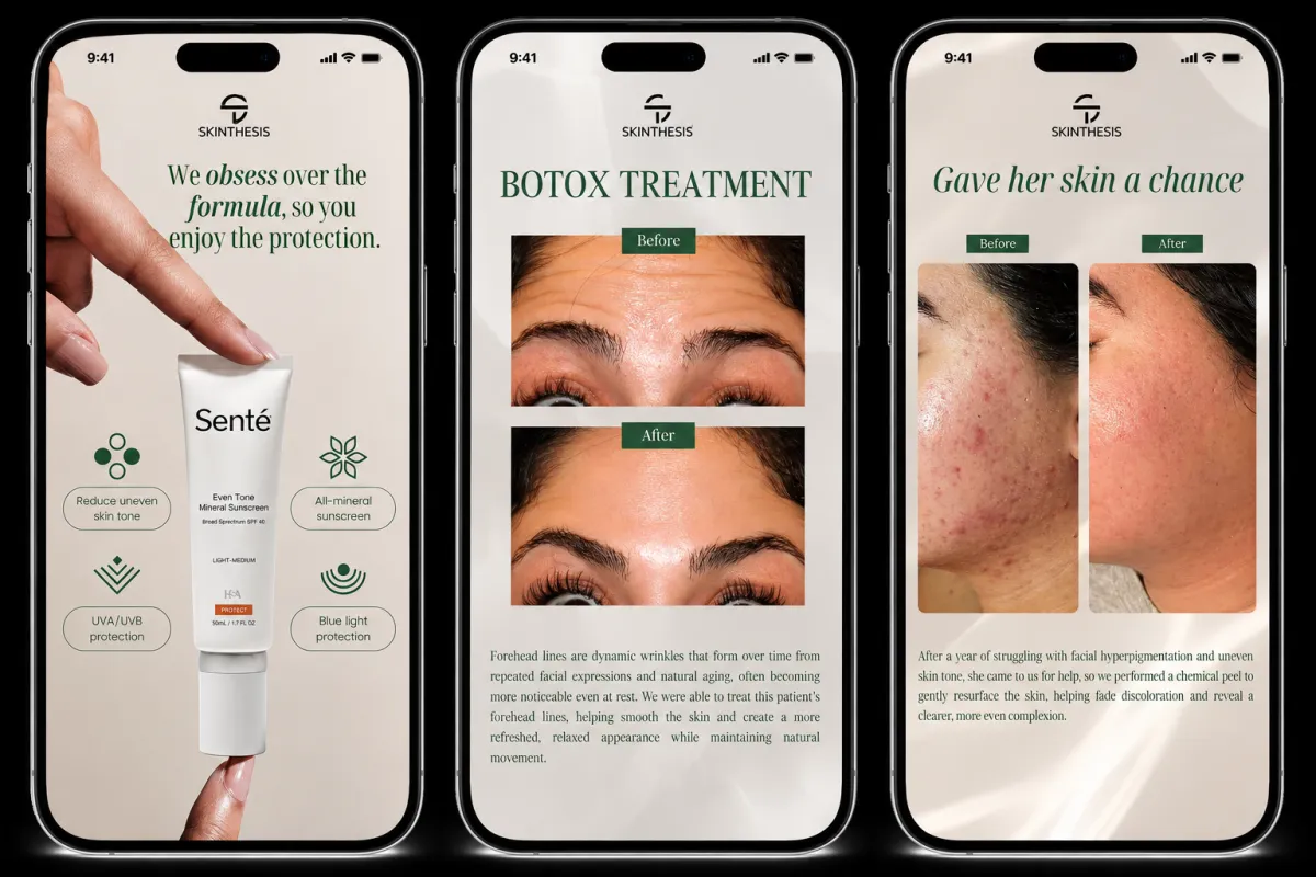Skinthesis medical aesthetic clinic social content — sunscreen, Botox, and chemical peel case studies by Roll The Media