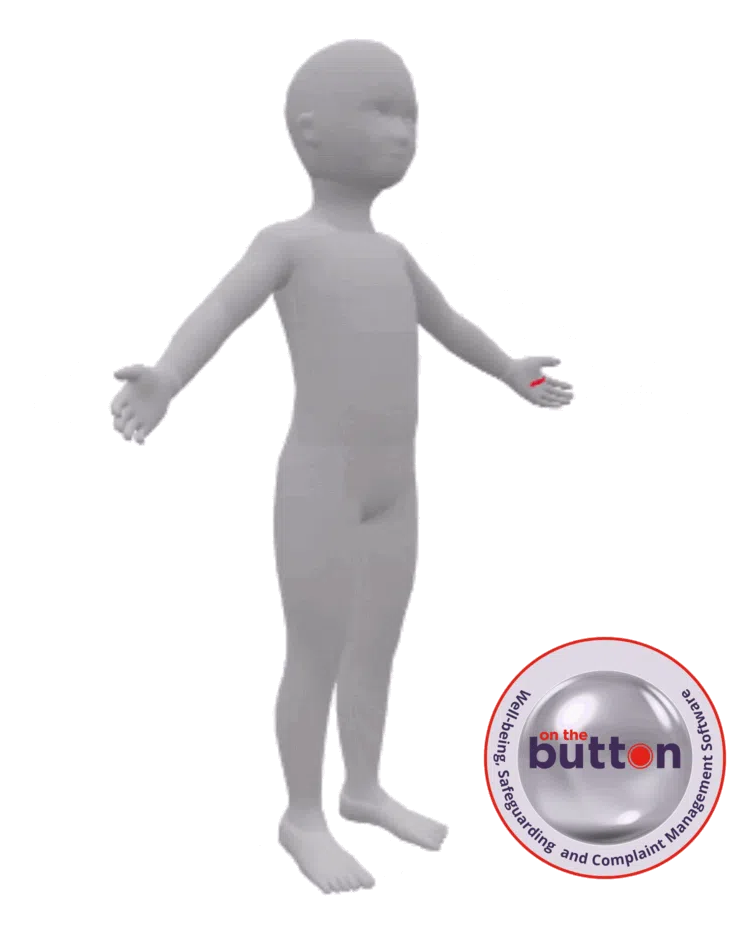 3D Body Map Safeguarding