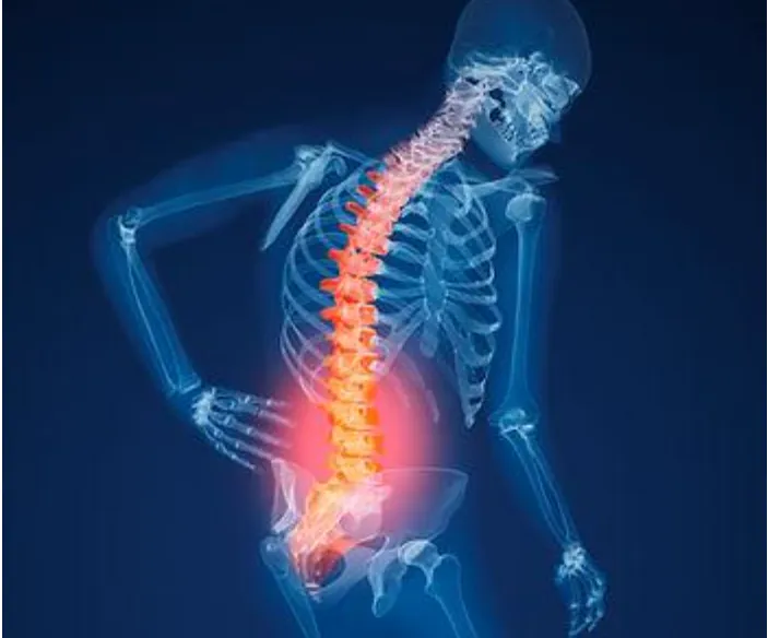 Osteoporosis